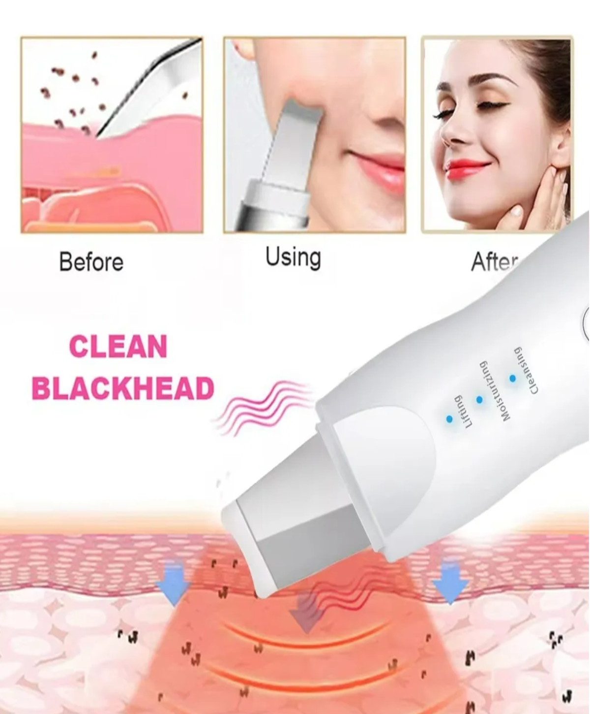 Limpiador Facial Ultrasonico Skin Scrubber Exfoliador Piel BLANCO